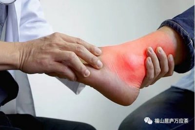 当代中国名医痛风高效验方