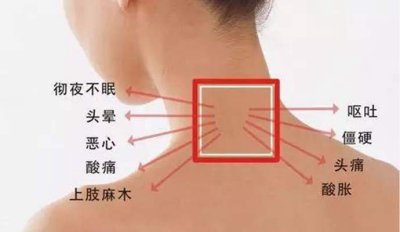 “葛根汤加减”治疗顽固性颈椎病经典名医名方